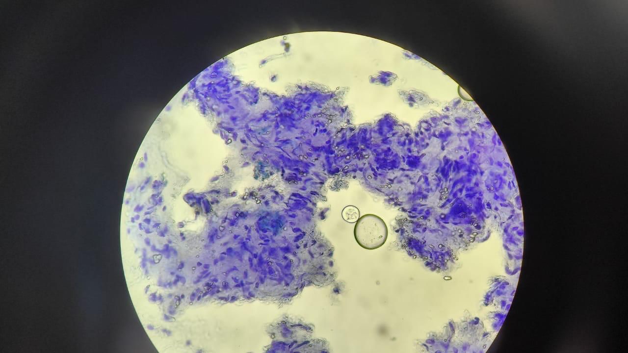 Histopathology